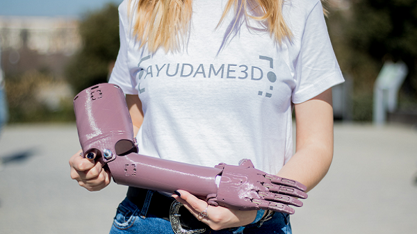 ELIX聚合物和合作伙伴使用rABS生产3D打印假肢＂title=